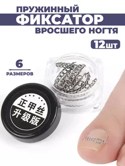 Домашняя установка скобы при вросшем ногте: пошаговый разбор