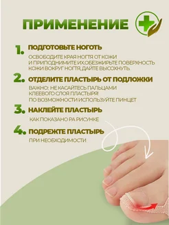 От вросшего ногтя пластырь корректор, от врастания на пальце фото 6