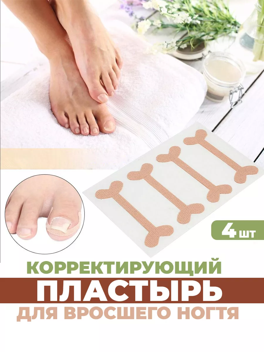 От вросшего ногтя пластырь корректор, от врастания на пальце