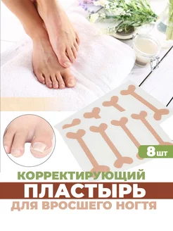 От вросшего ногтя пластырь корректор, от врастания на пальце фото 1