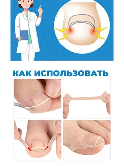 От вросшего ногтя пластырь корректор, от врастания на пальце фото 3