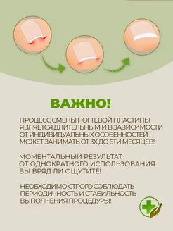 От вросшего ногтя пластырь корректор, от врастания на пальце фото 7