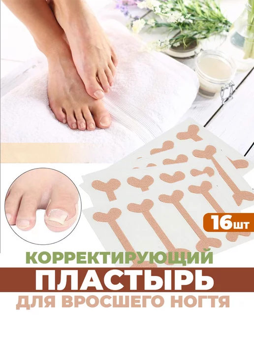 От вросшего ногтя пластырь корректор, от врастания на пальце