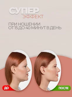 Маска бандаж для лица и подбородка фото 3