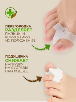 Межпальцевые разделители фото 3
